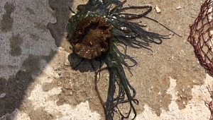 Biga'da Korkunç Olay,Denize giren 12 yaşındaki kızın yüzüne çarptı